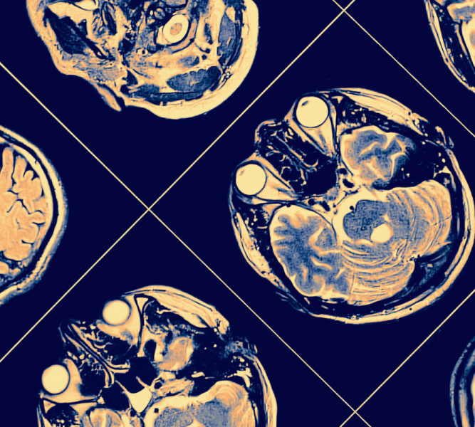 header-stm-2022-motor-and-cognitive-systems-in-neurodegeneration-667x600.png